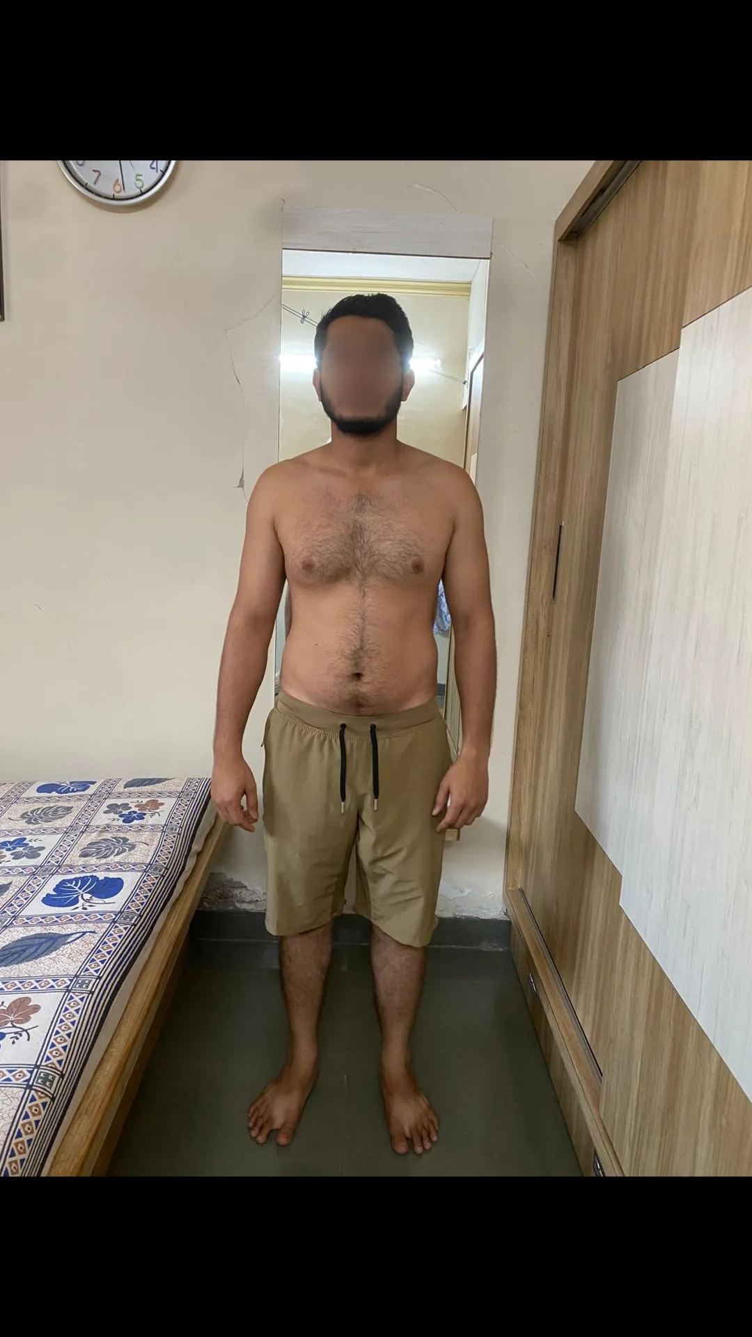 Fuzail before